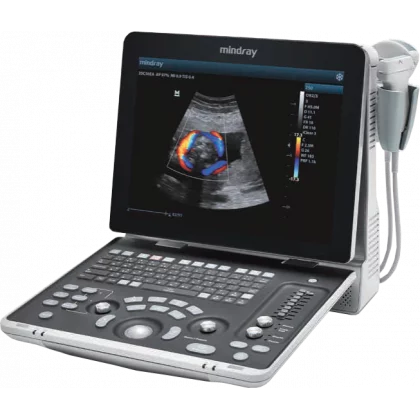 ECHOGRAPHIE DOPPLER COULEUR , PORTABLE 3 SONDES